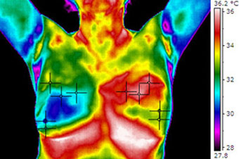 Permen Naturopathic provides breast thermography